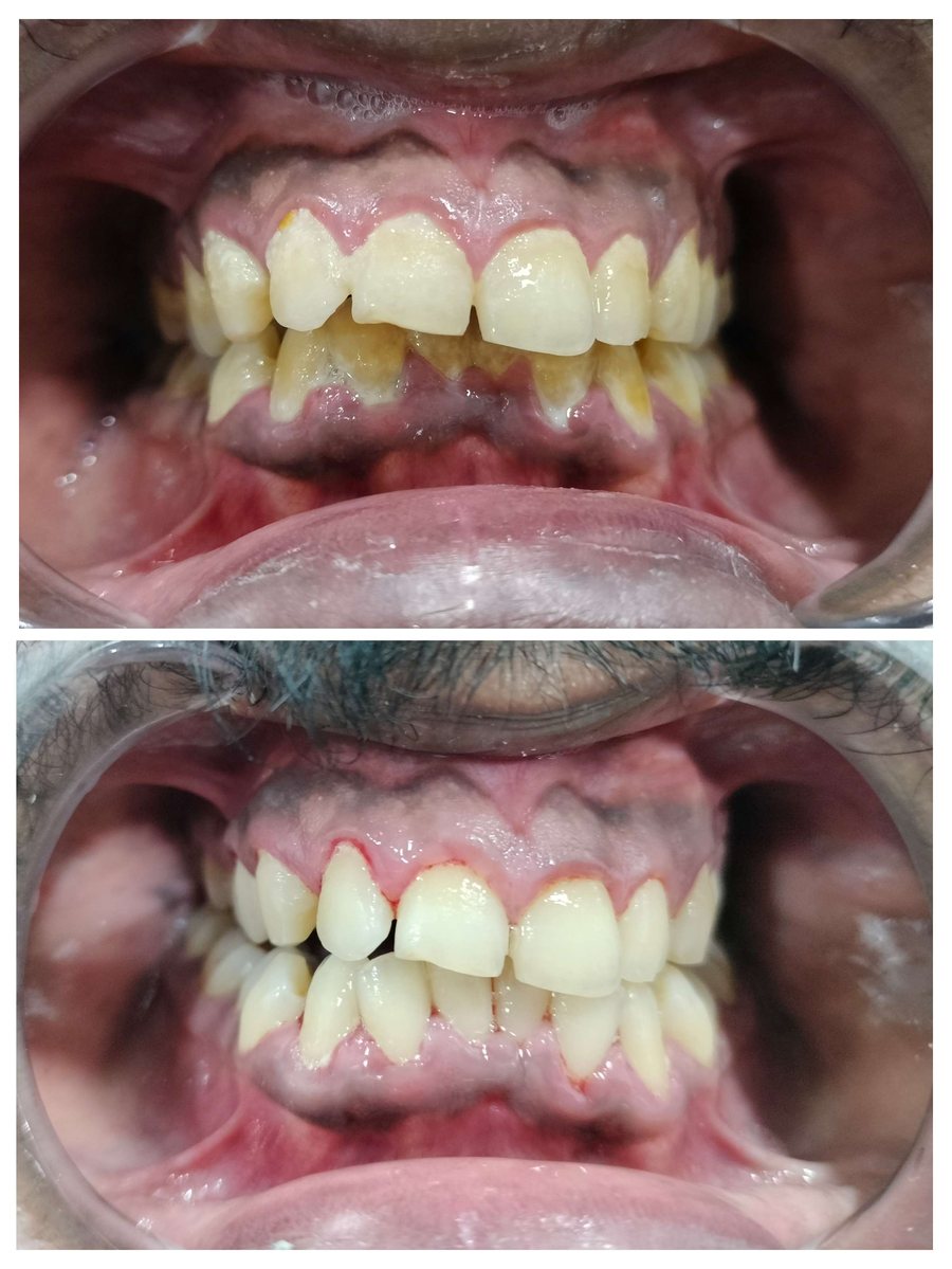 Before and after scaling